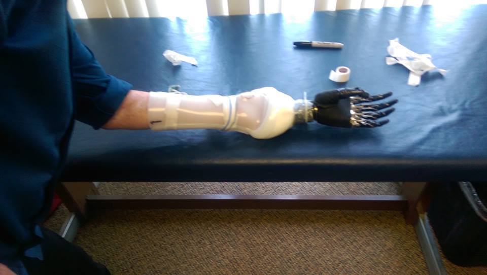 Cliff Golby's be bionic mechanical arm