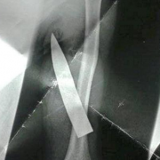 Knife in arm x-ray